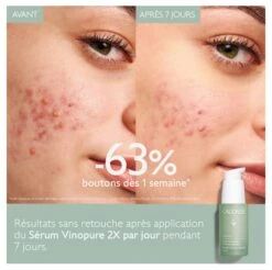 Caudalie Vinopure Blemish Control Salicylic Serum 30ml 9 Caudalie Vinopure Blemish Control Salicylic Serum 30ml -Care Product Store caudalie vinopure blemish p54905 g 3 fr.jpeg
