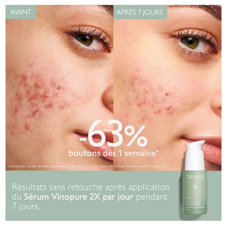 Caudalie Vinopure Blemish Control Salicylic Serum 30ml 5 Caudalie Vinopure Blemish Control Salicylic Serum 30ml - Image 3